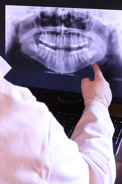 Best Emergency Dental Extractions in South Lancaster, MA